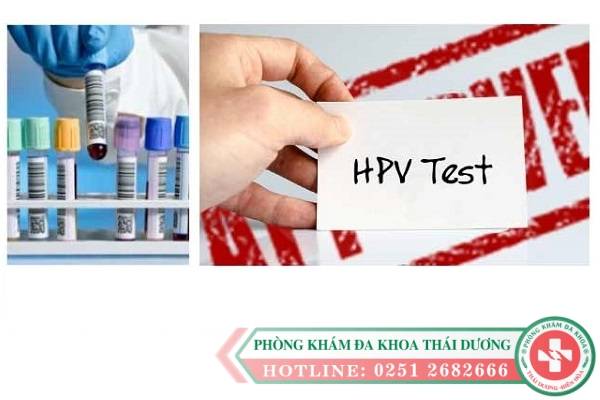 Xét nghiệm kiểm tra HPV